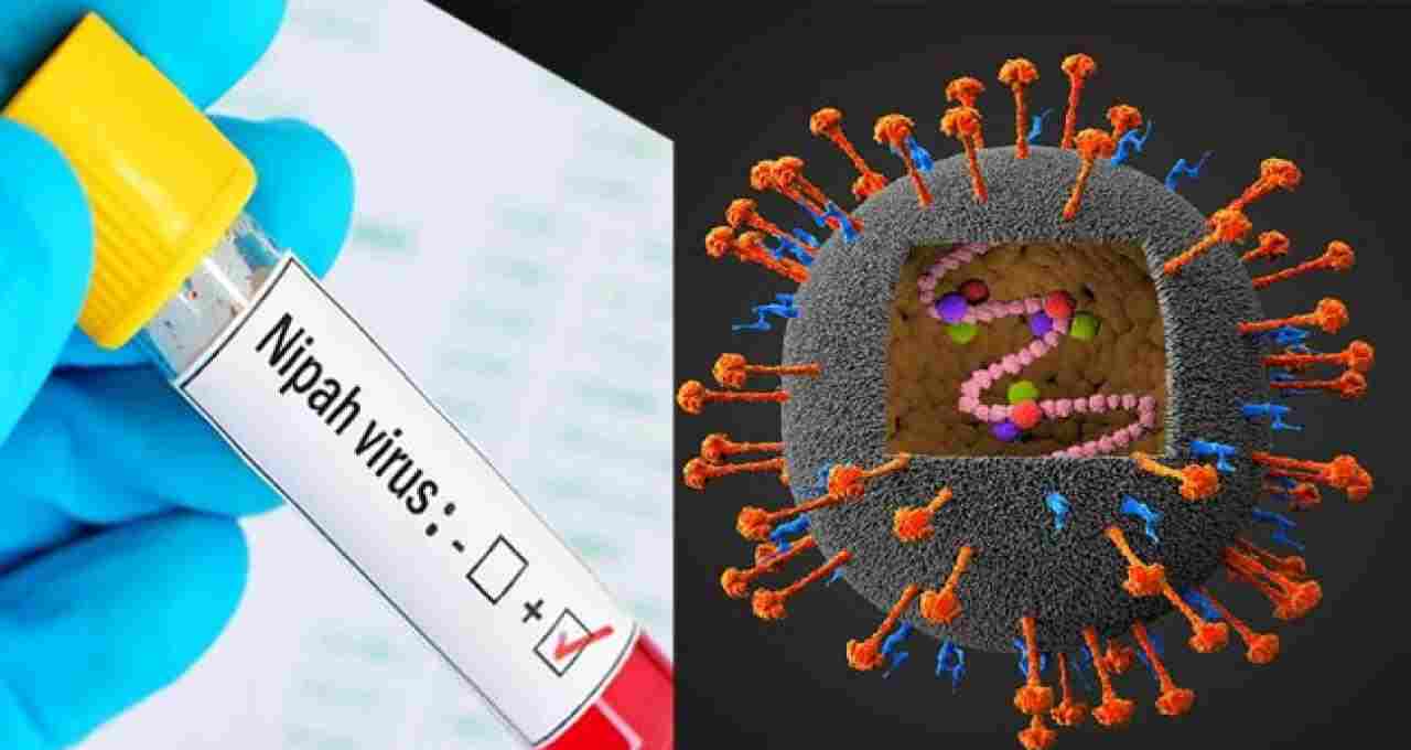Nipah Virus: Causes, Symptoms, Diagnosis & Treatment